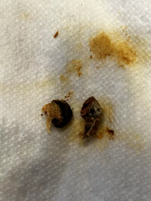 Earwax my wife pulled out of my ears today.