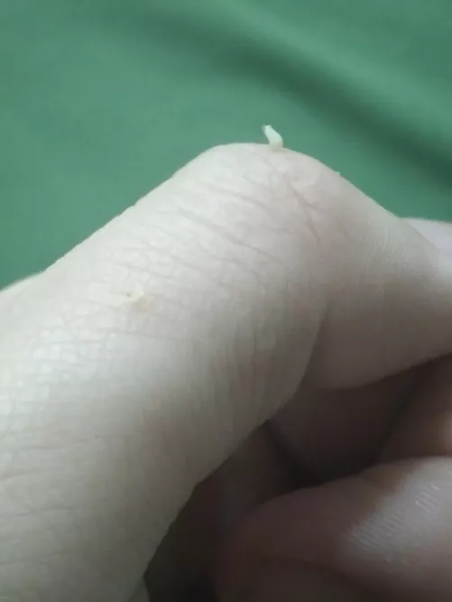 Found them on my neck