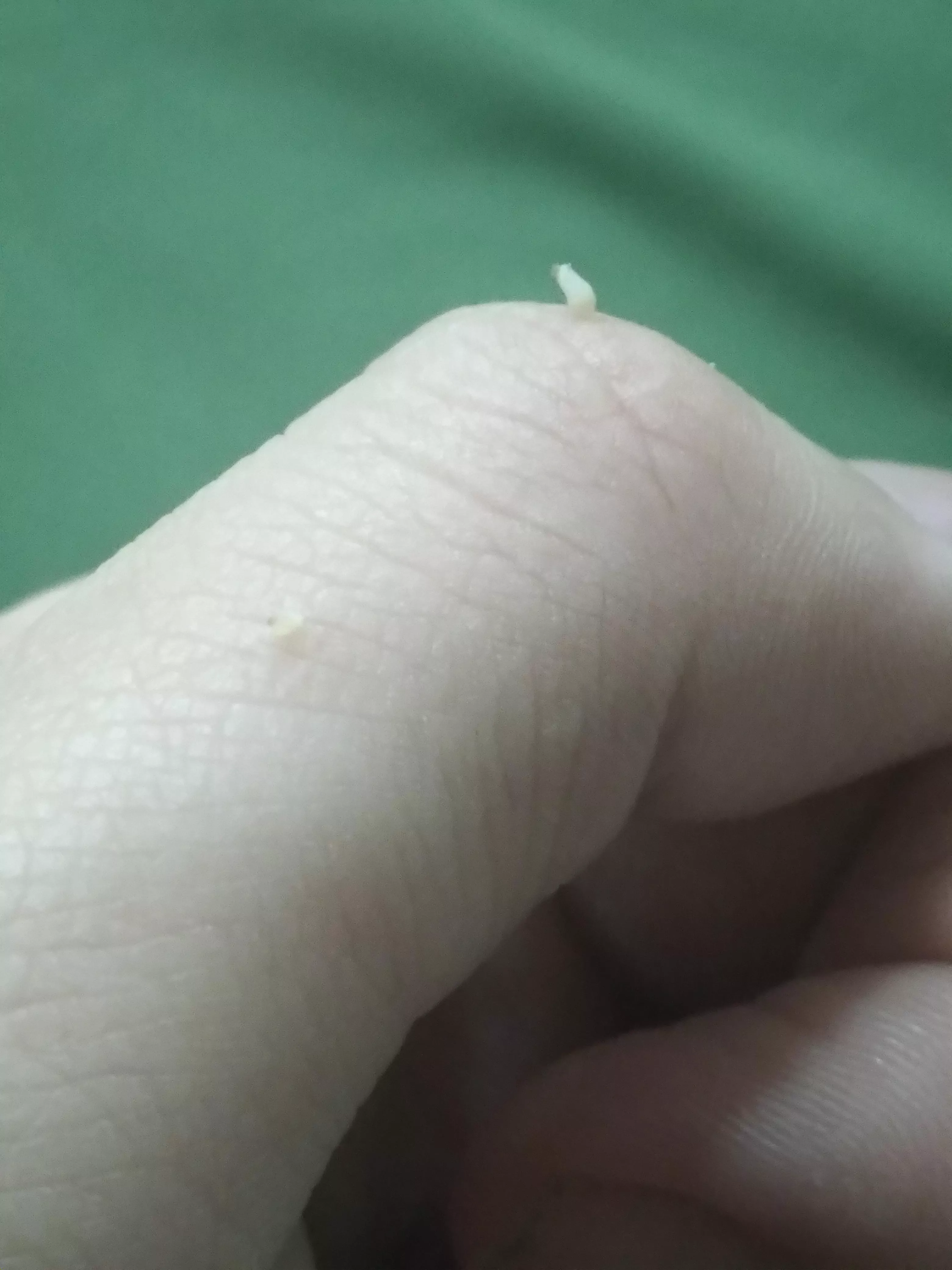 Found them on my neck