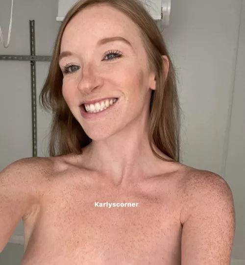 Freckles are my favorite