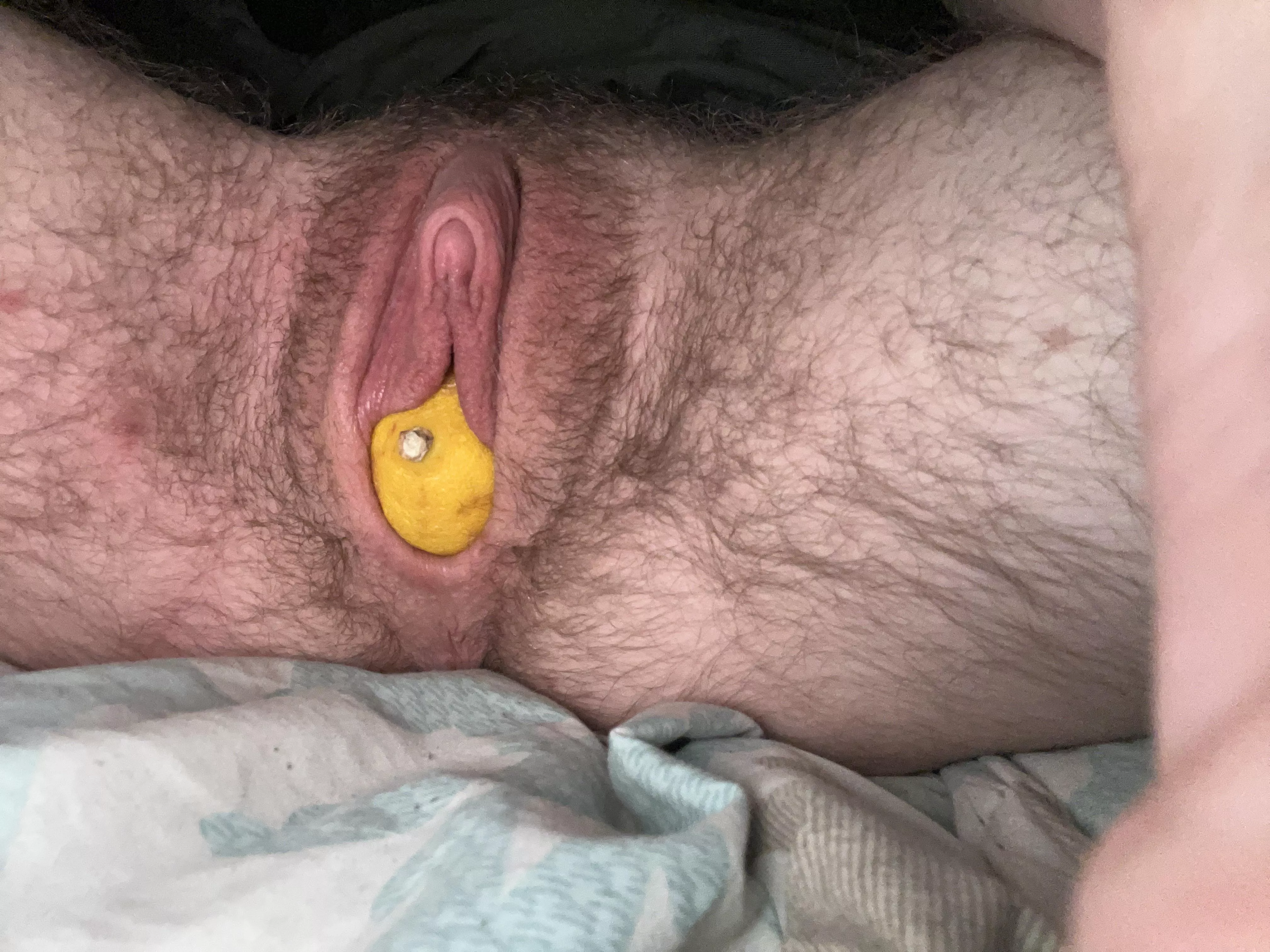 (Ftm18) This wasn’t my idea hehe.. 🫣 lemons!