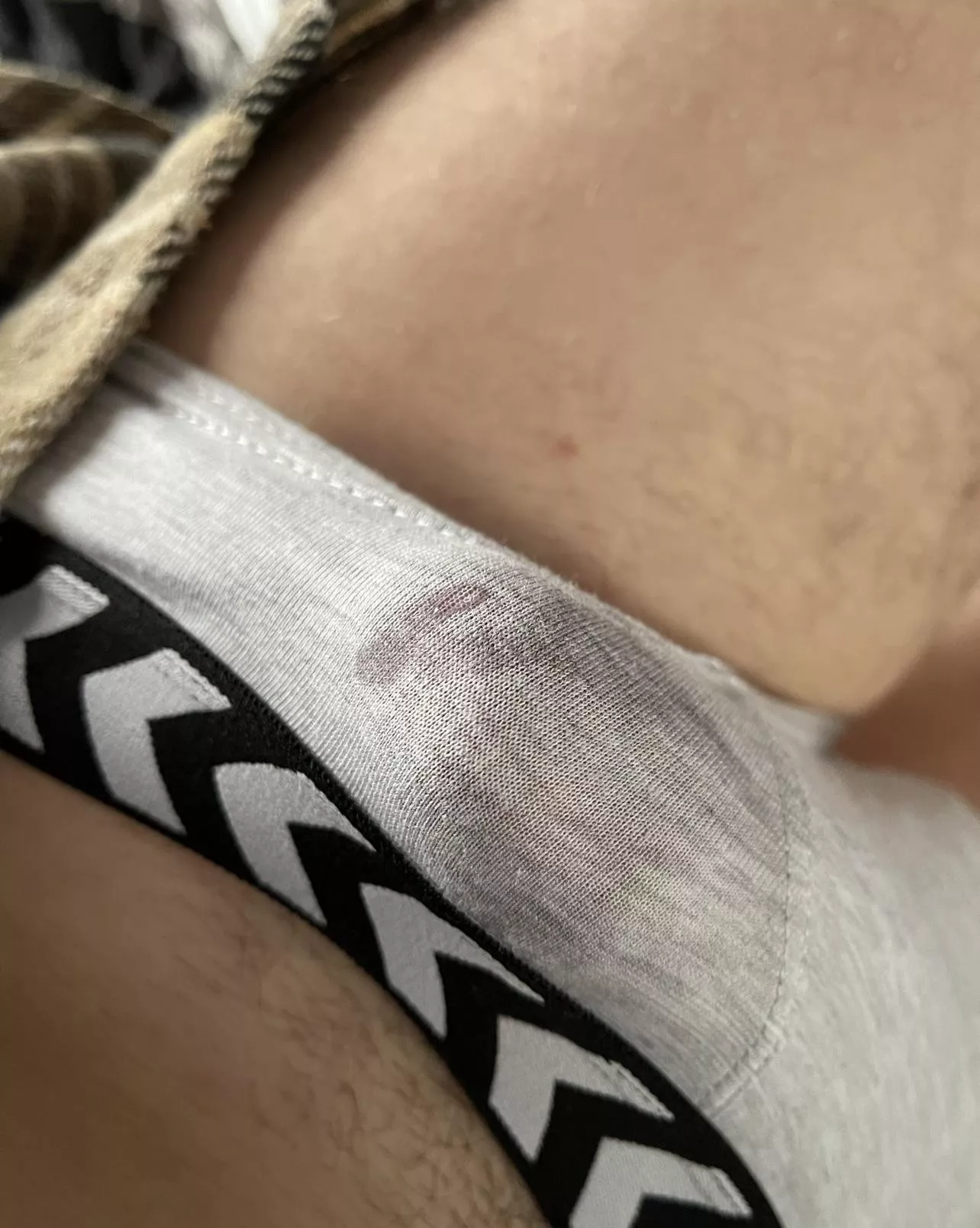 Leaking out of my underwear