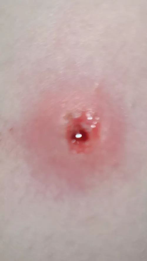 pit ob my leg after a mental break down 🫠