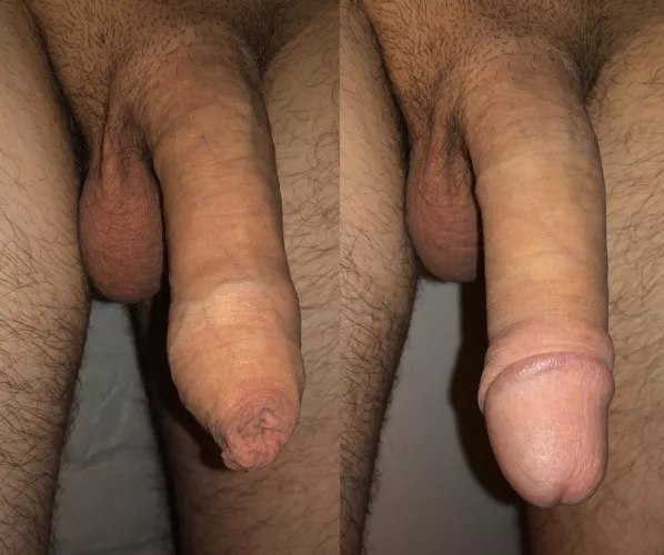 With or without the skin?