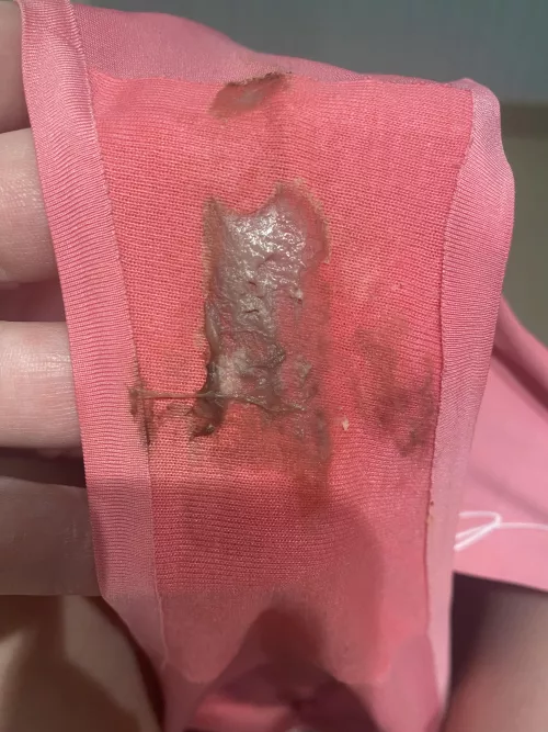 Not for the faint of heart. When spotting combines with some thick grool. Never seen it quite like this!!! I was super horny today too.