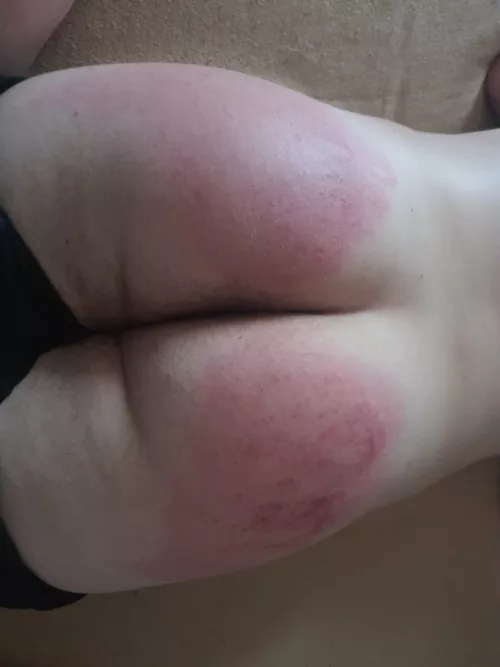 The consequences of masturbation