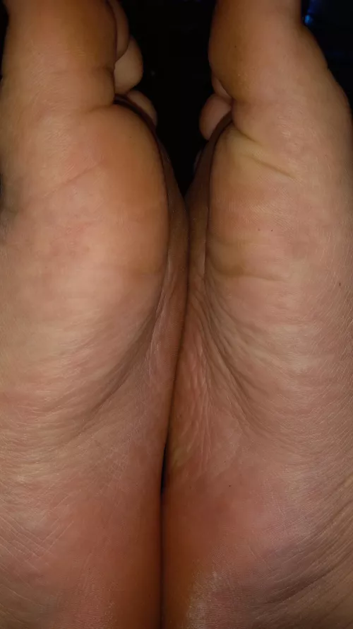 Would you kiss them?