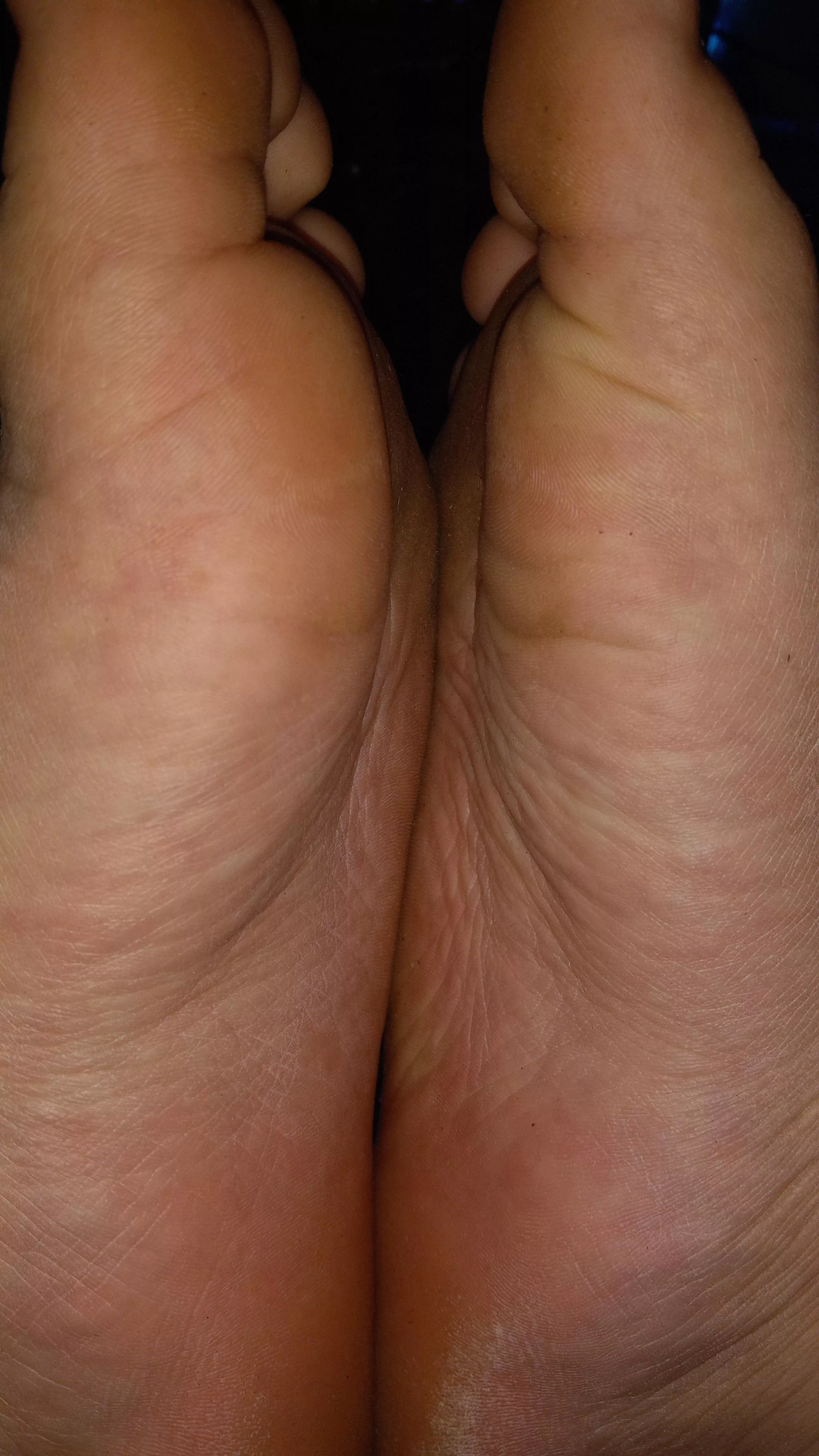 Would you kiss them?