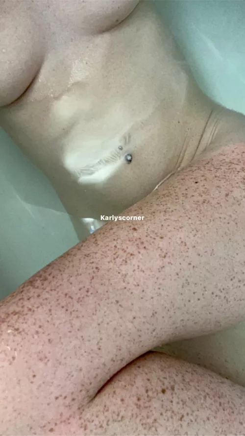 Do you like my freckles?