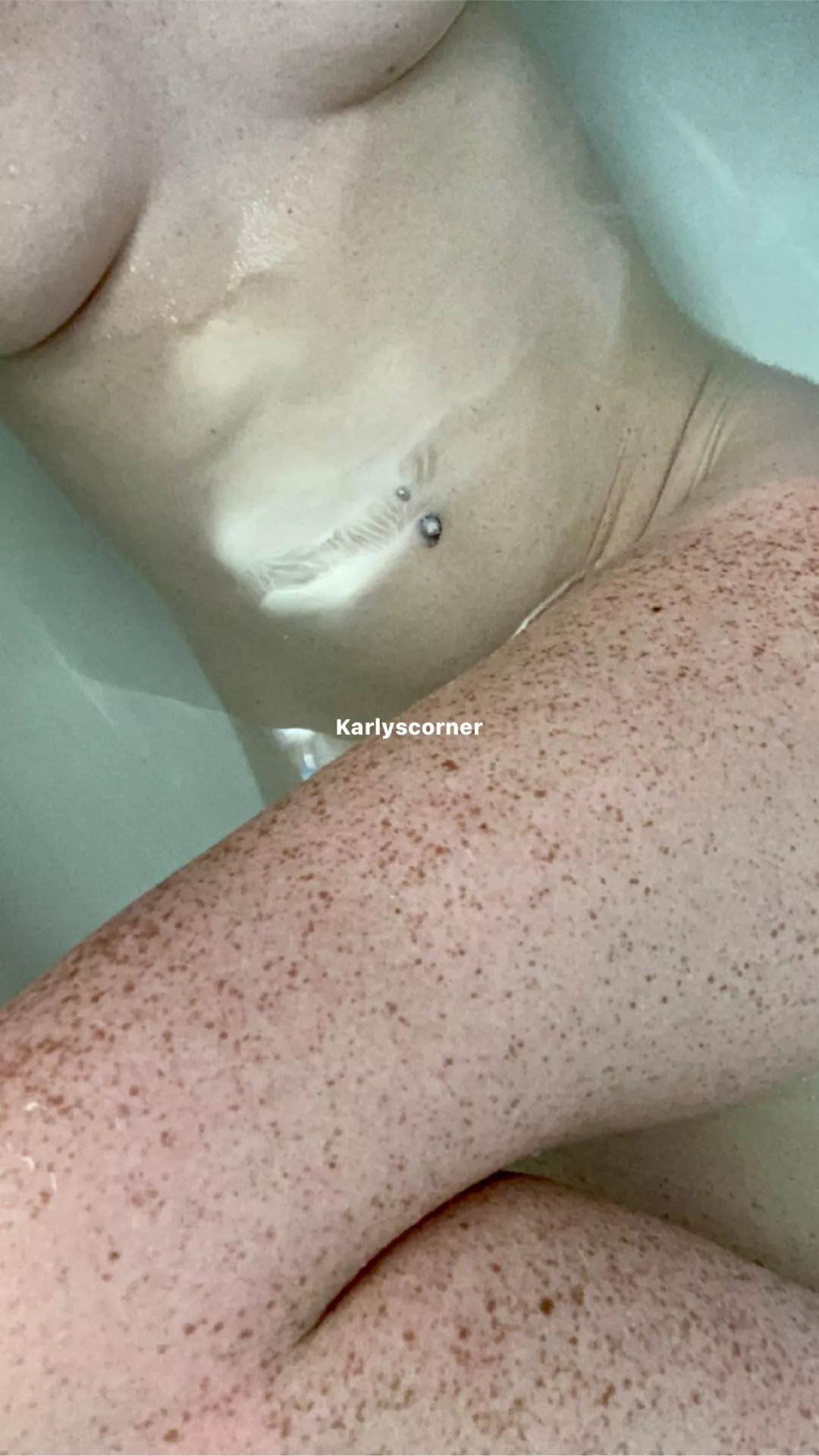 Do you like my freckles?