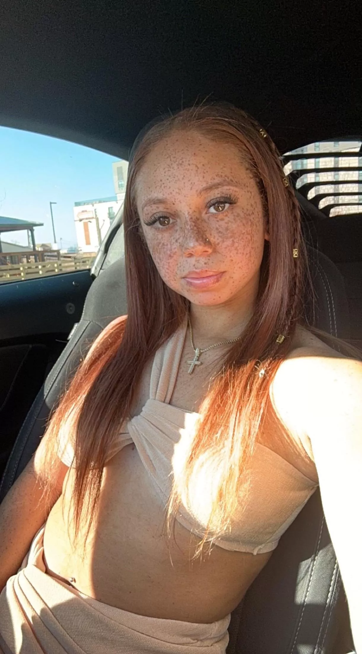 Do you like my freckles?