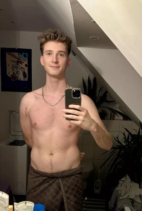 Two months since the surgery on my arm, what do you think about the scar?