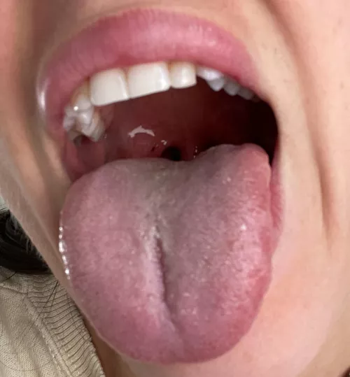 You can almost see my uvula