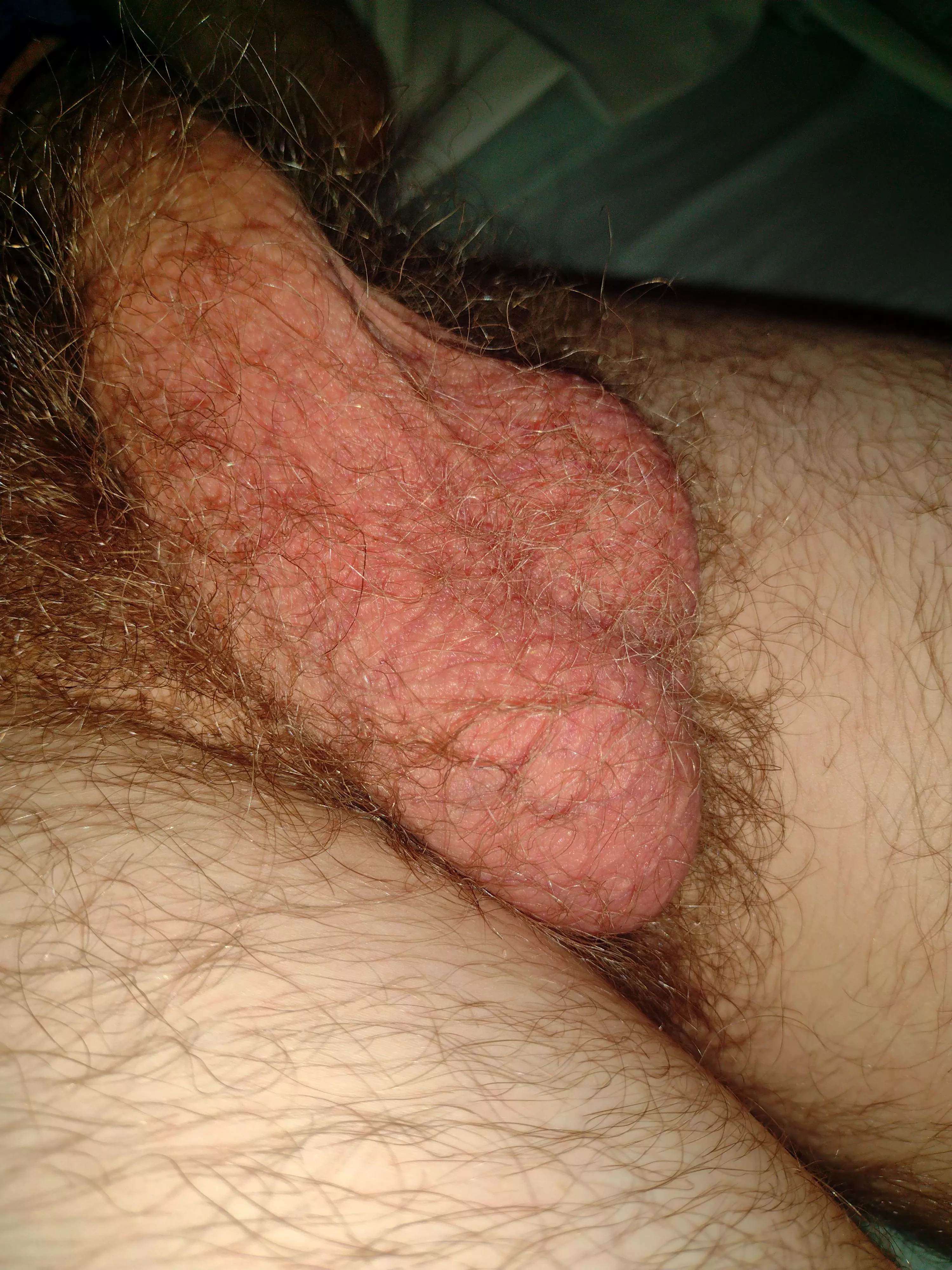 [18] hope the hair isn't a problem