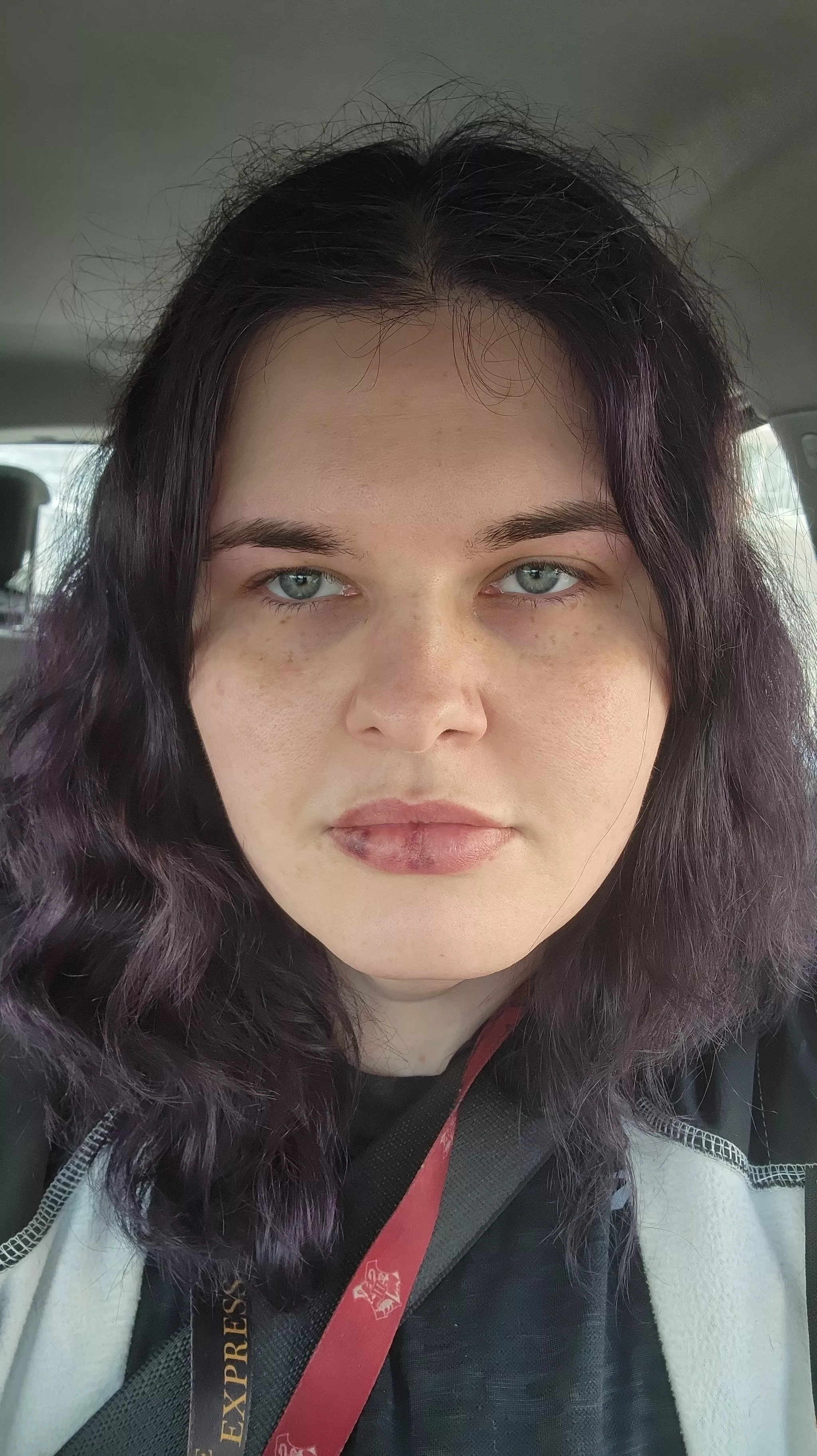 As advised got my eyebrows done and lips are looking less bruised.