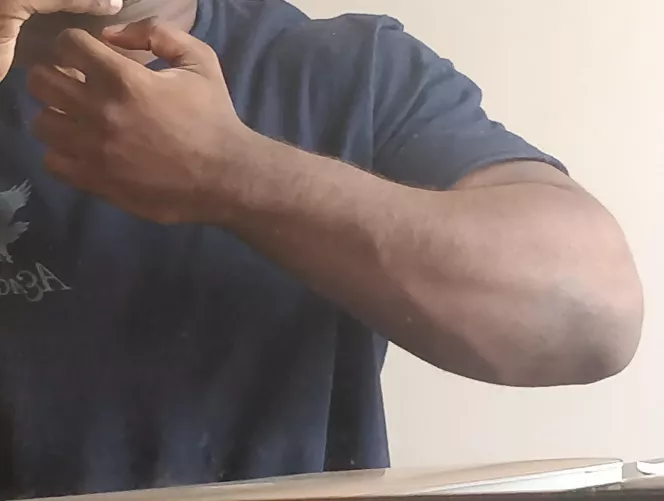 Good Fore Arm Or Bad Fore Arm 🤔🥴