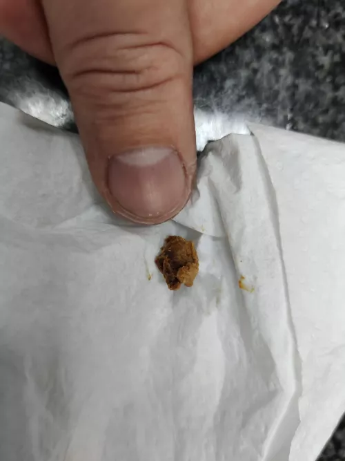 I rinsed it out of my ear today