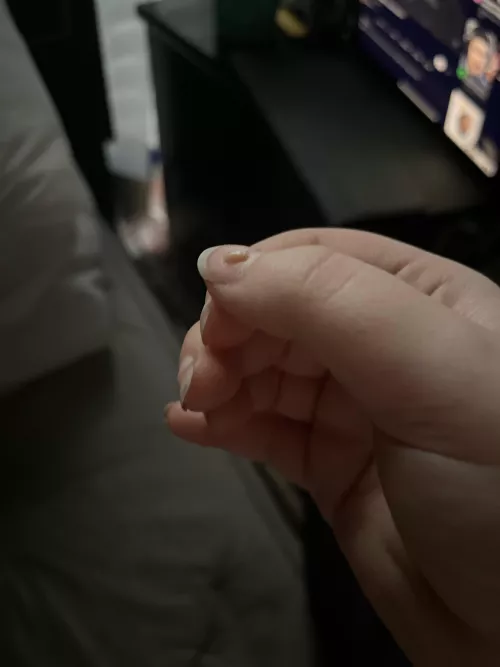 This sucker just popped out of my side under where my bra strap sits.