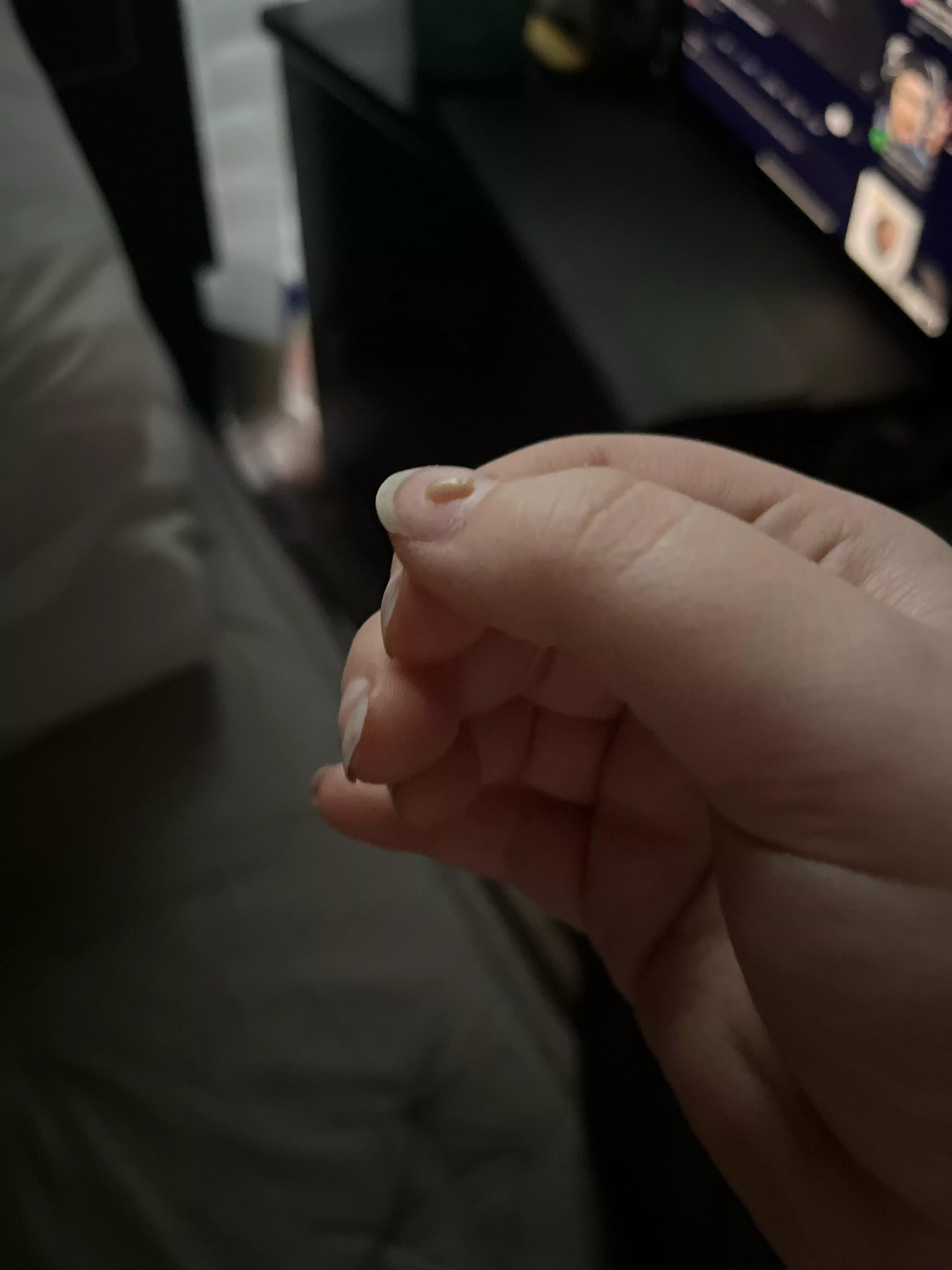 This sucker just popped out of my side under where my bra strap sits.