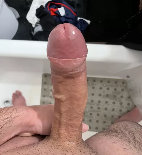 Foreskin barely covers my head