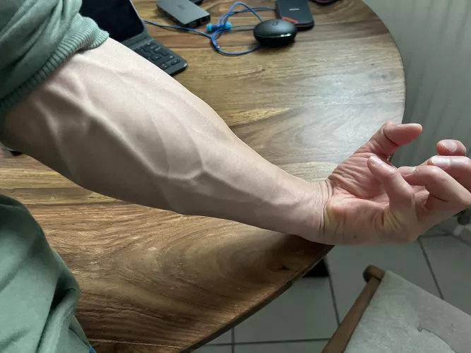 Goodnight Forearm :)