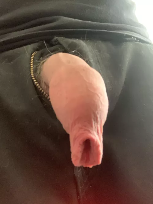 My long foreskin