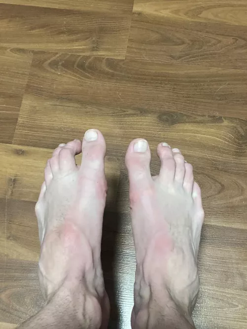 Post shower pic [26]