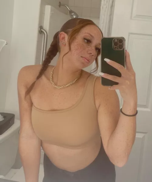 Someone said they could play connect the dots on my face lol