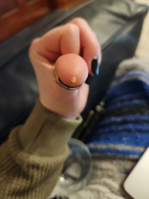 this just came out of my scalp?? what is it?