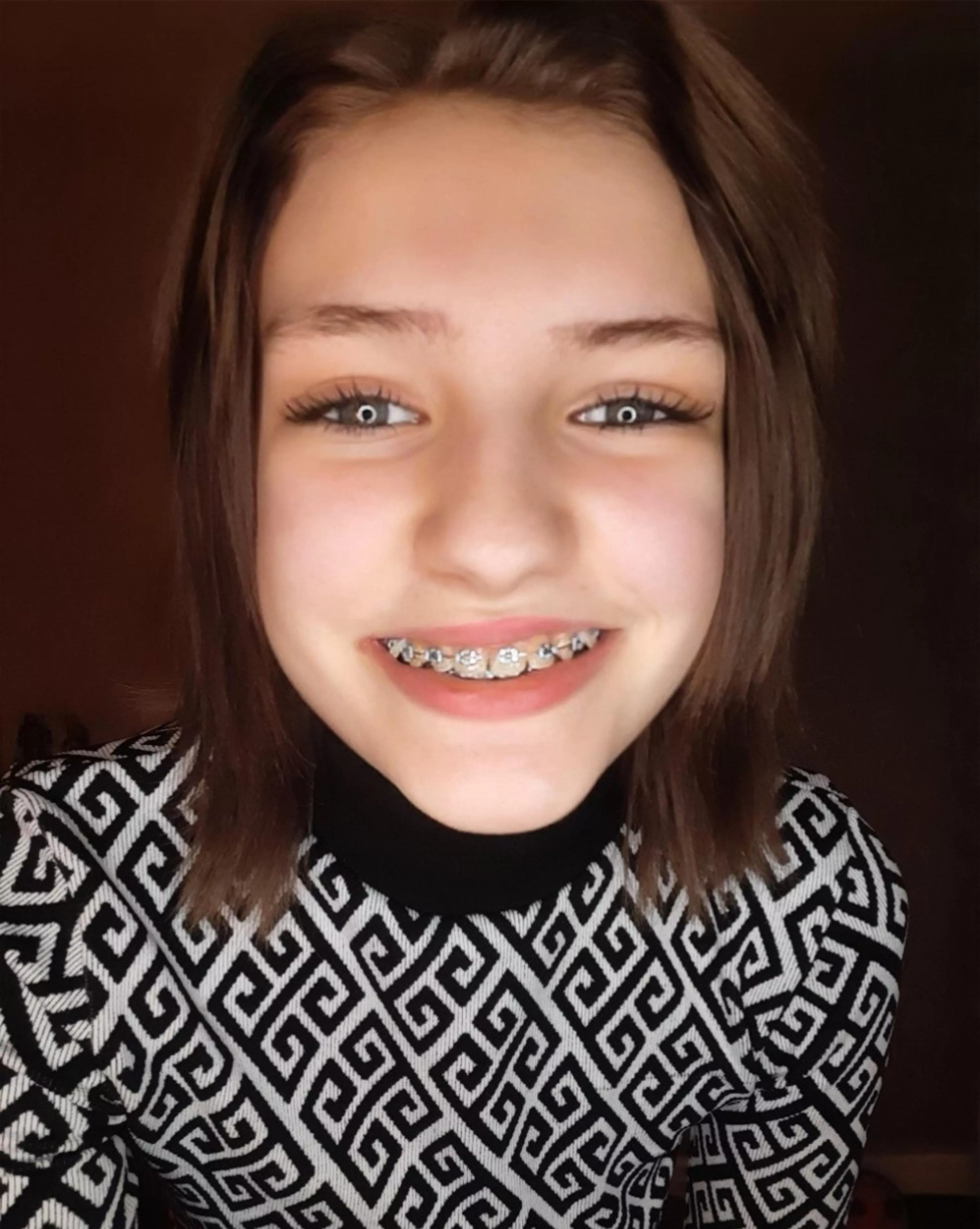 A close up of my face and my braces, now you have to spunk all over it ~♡