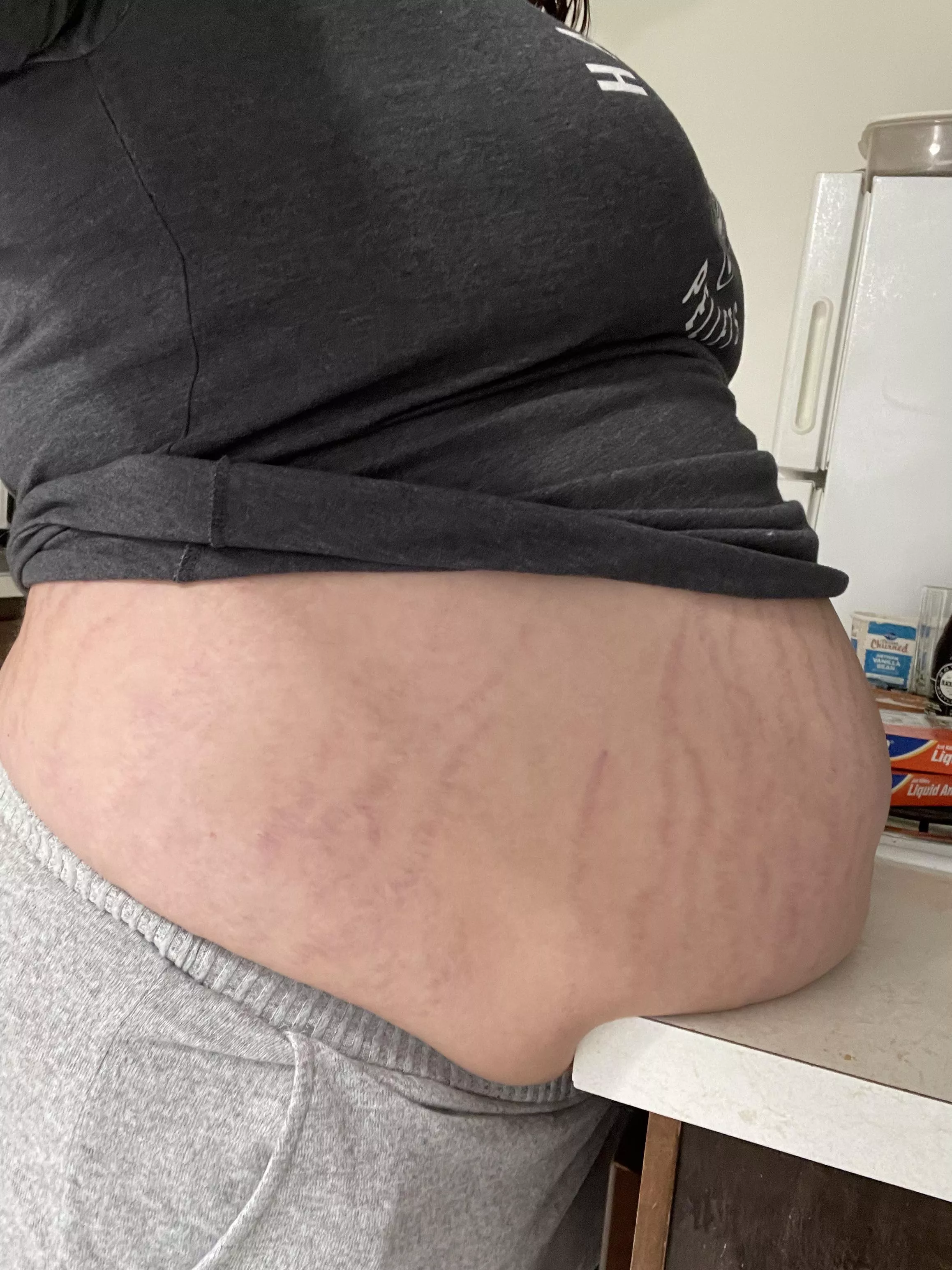 Filling myself with root beer floats until my stretch marks get bigger and redder.