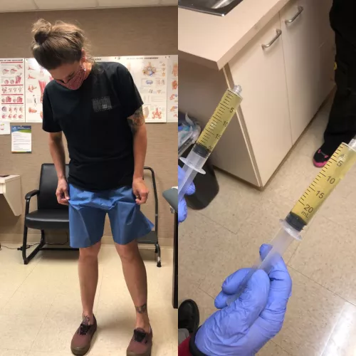 I got my Bakers Cyst drained. They took pictures and everything. I feel like if they had a trophy I would have received one.