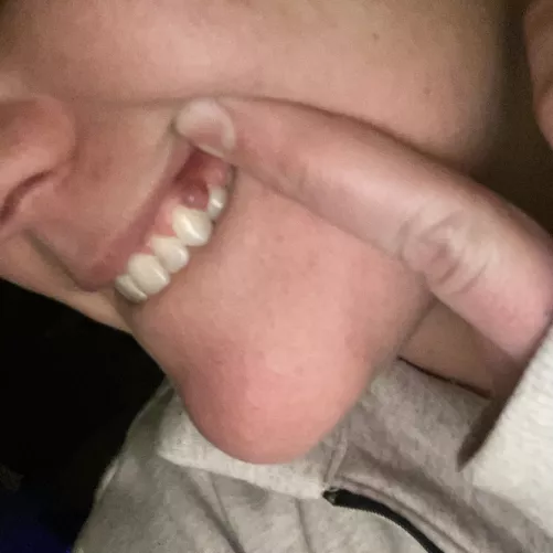 Long time lurker, first time poster. Don’t know where this came from but it’s a real bitch. Have dentist appointment Tuesday 👍