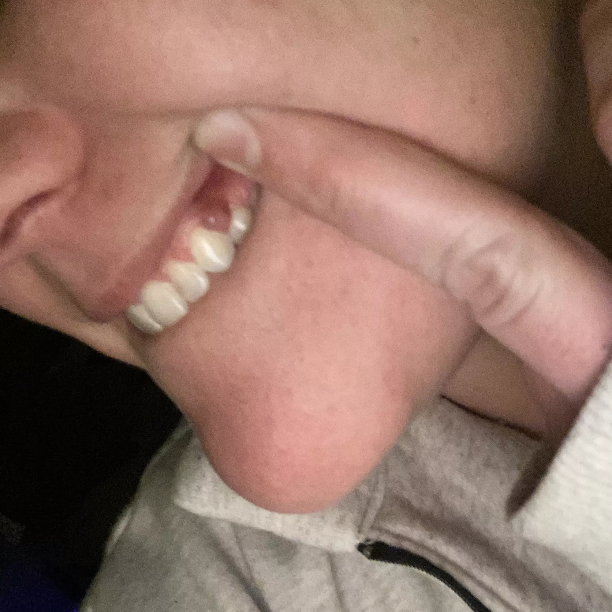 Long time lurker, first time poster. Don’t know where this came from but it’s a real bitch. Have dentist appointment Tuesday 👍