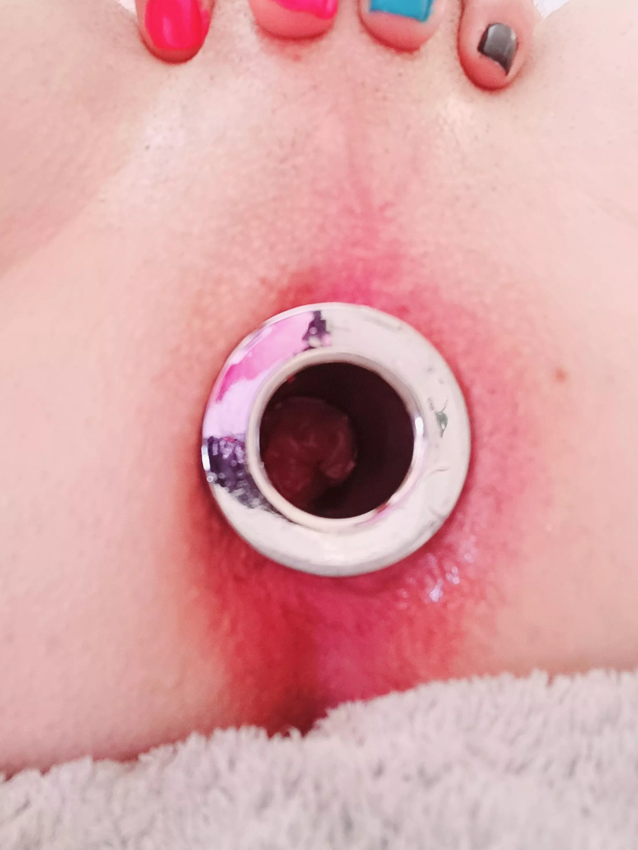 My insides with an assisted gape...