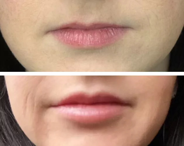 Wife's new lips. What do you think?