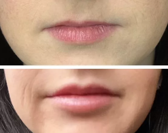 Wife's new lips. What do you think?