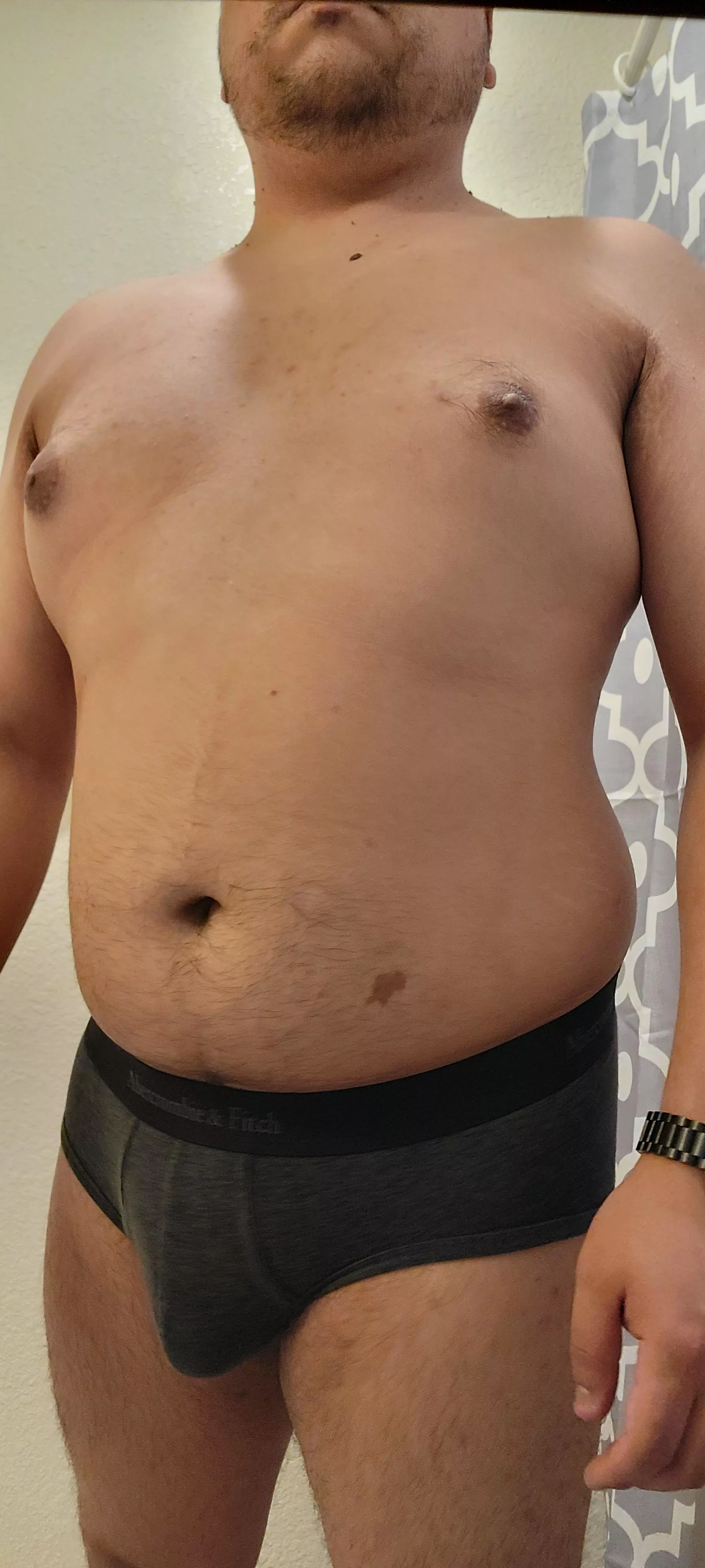 30M at home sick, anyone what to chat? DMs are always open.