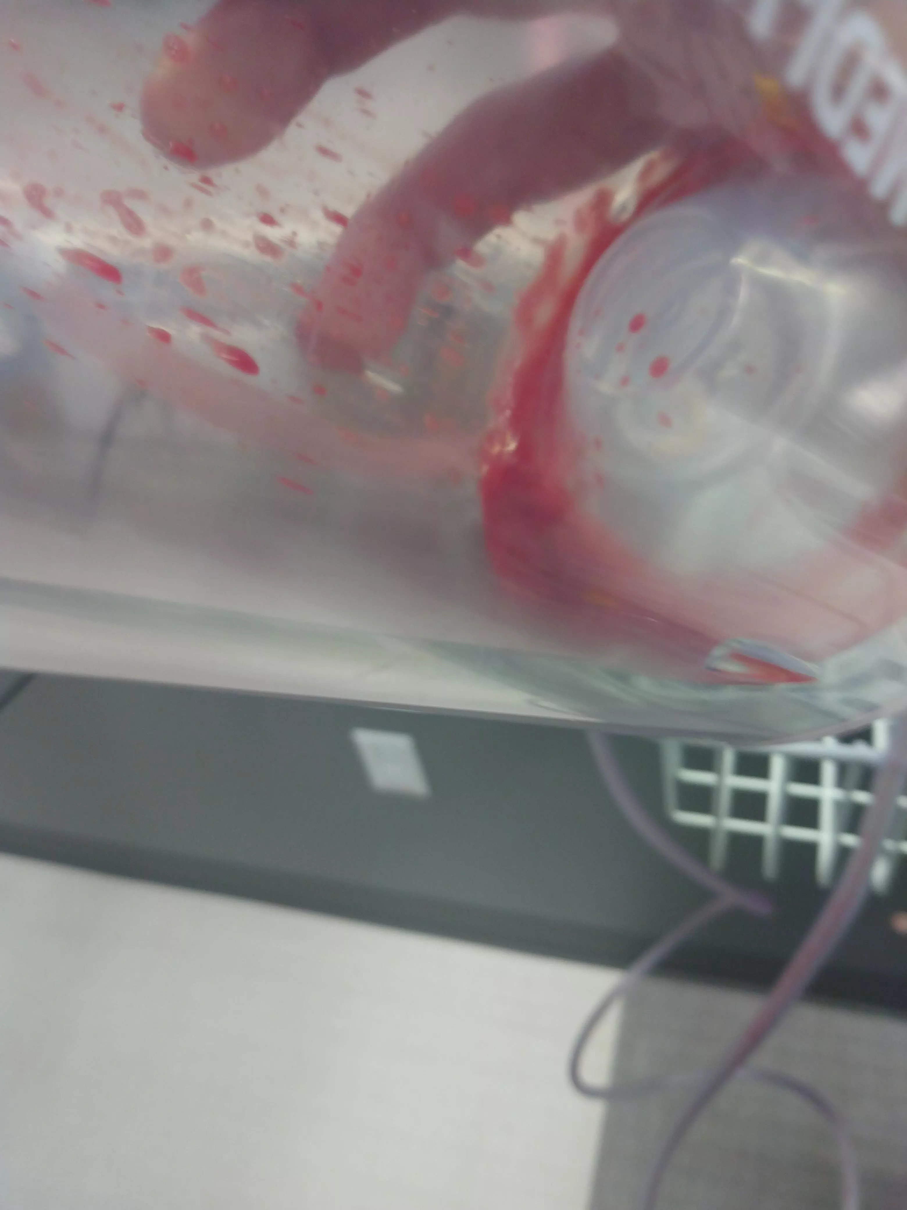 post abscess drainage, sorry i couldnt get anything better but here's some nasty goo that gushed out