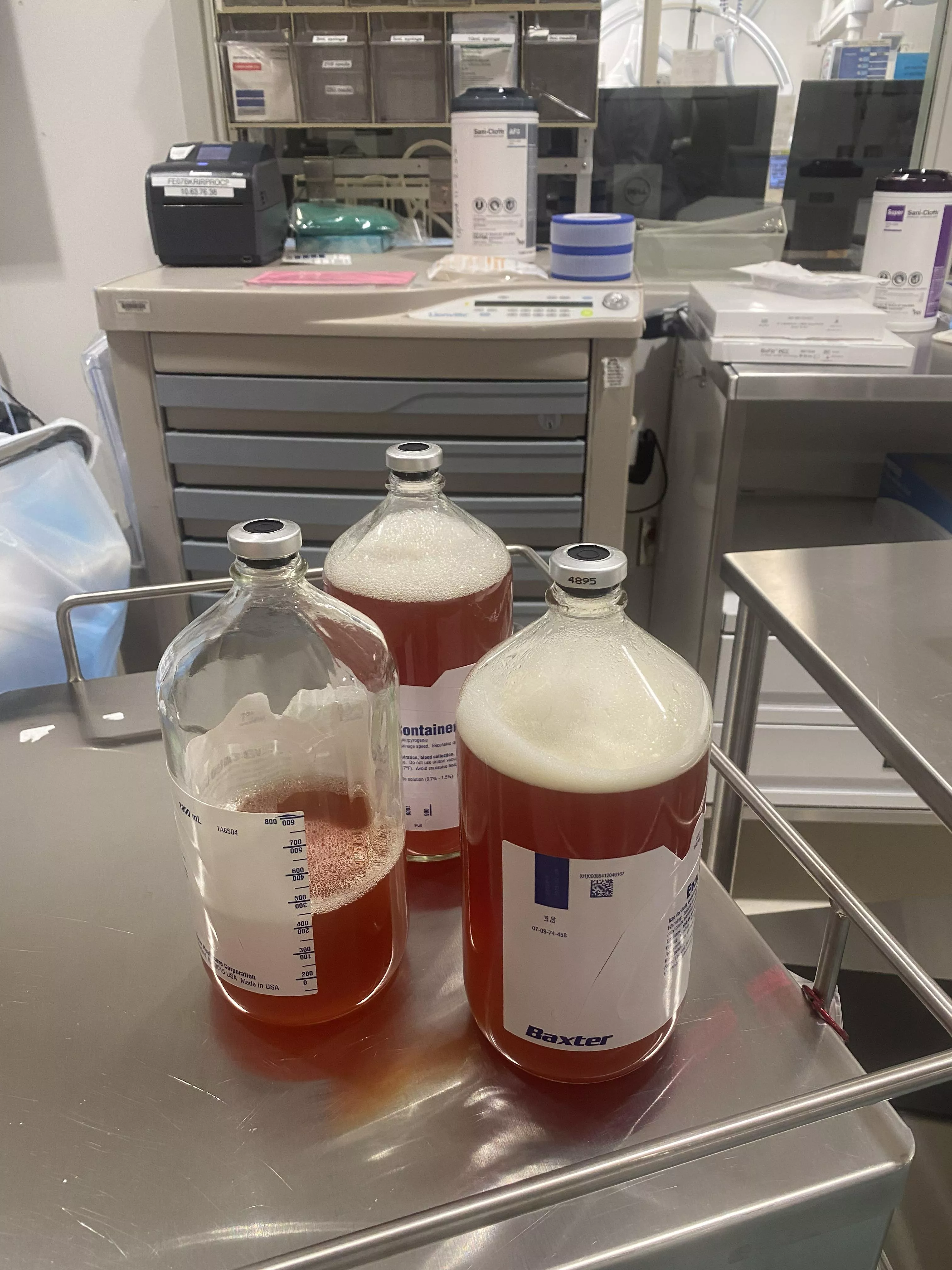 Since we’re posting drainage fluid, I had my first ever paracentesis back in November…All of this plus another 0.3L for lab…Total was 2.8L