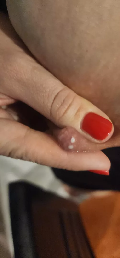 The Twins Are Full! How Quickly Can You Get Here?