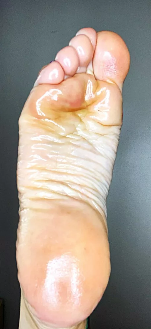 Count all the wrinkles