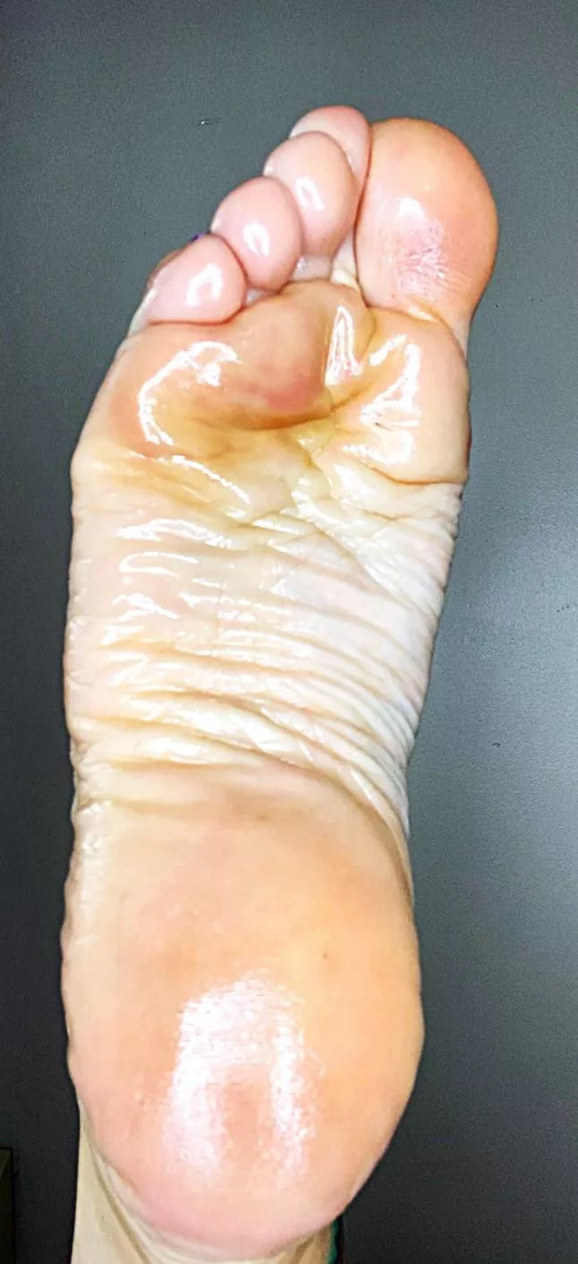 Count all the wrinkles