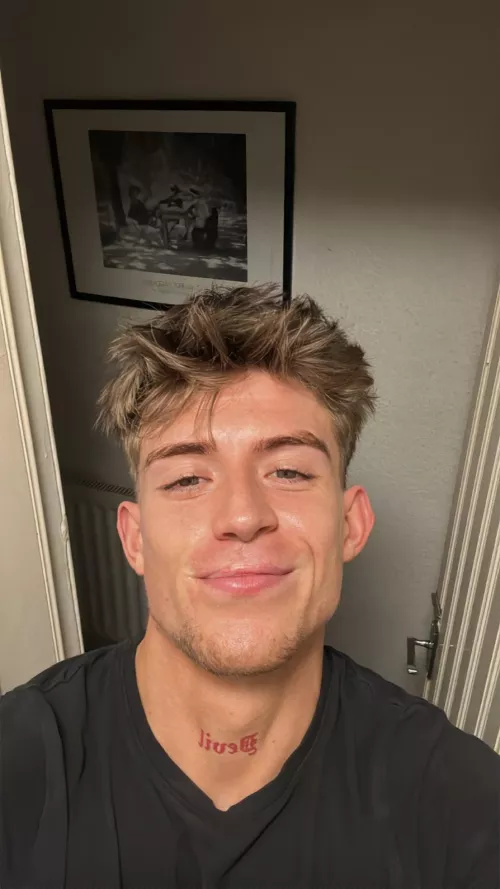 Does the scar on my lip turn you off? I have had loads of negative replies and feel like my future man will reject me for it or for how people see it :(