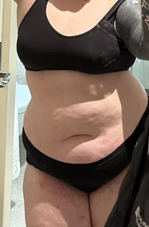 I’m losing weight. However, losing weight when you’re heavy means going from fat to fat still. But I’m proud of my progress. Also I suffer from dermatitis hence the redness. Please be kind and considerate regarding that (had blood tests and swabs i