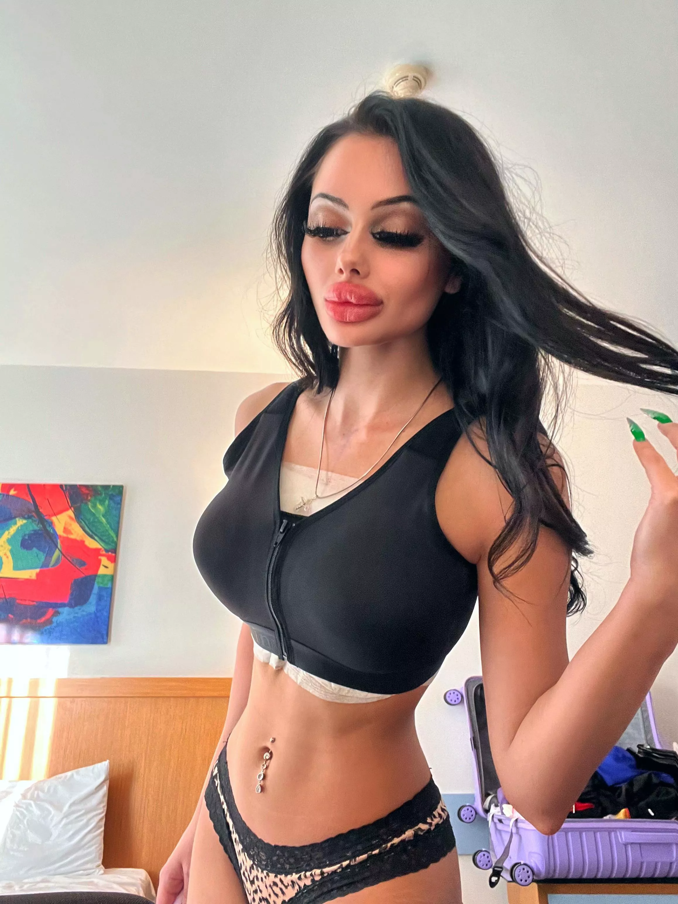 My first plastic boobs, got them 3 days ago