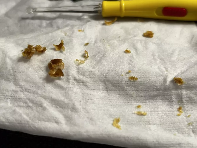 My son asked me to clean his ears