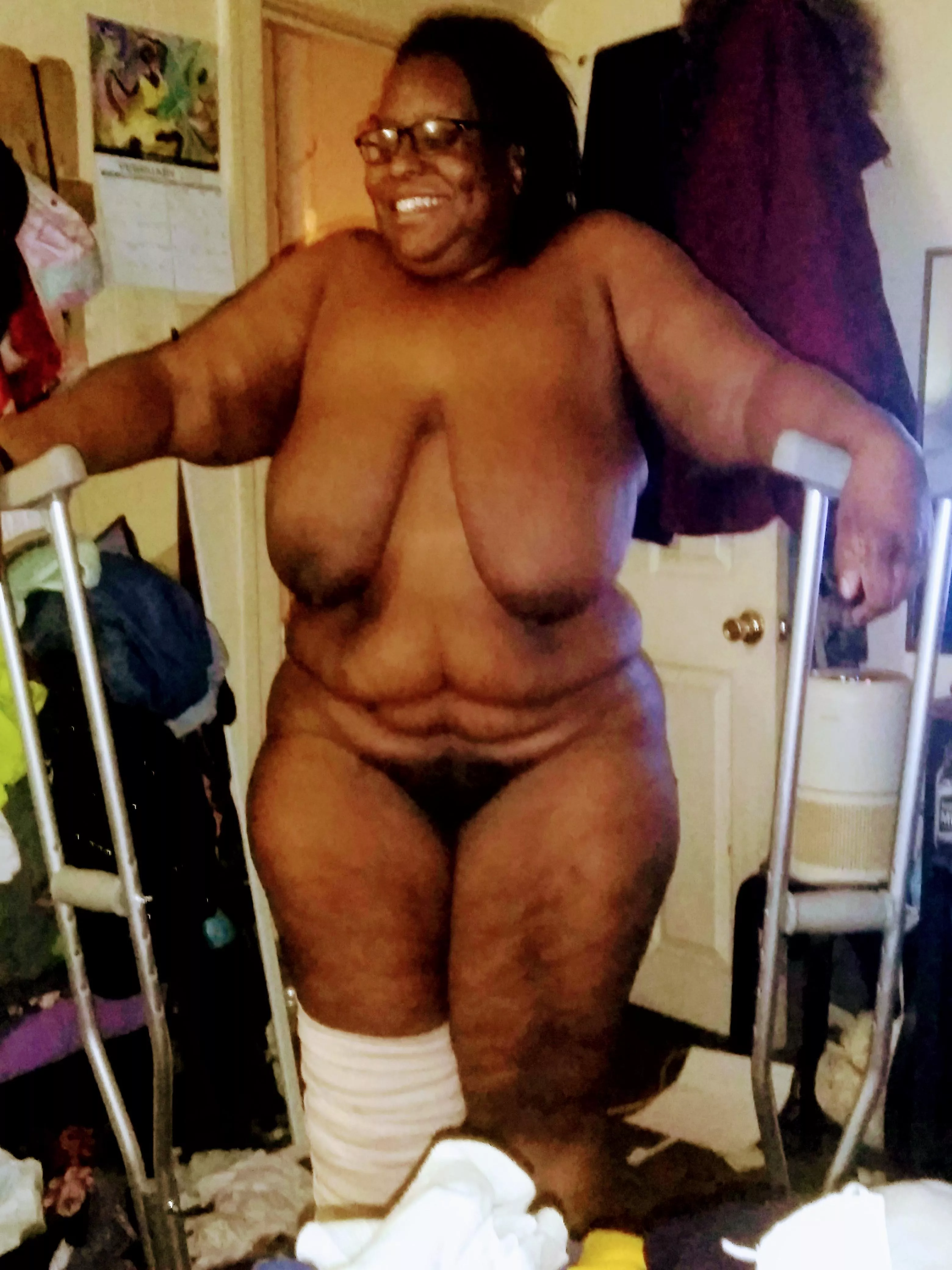 Post surgery and the clothes are gone now and I'm not complaining