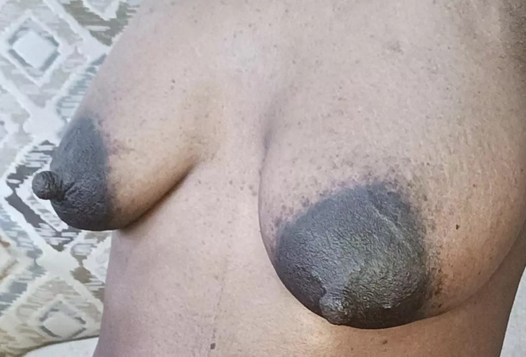 They are growing with every suck