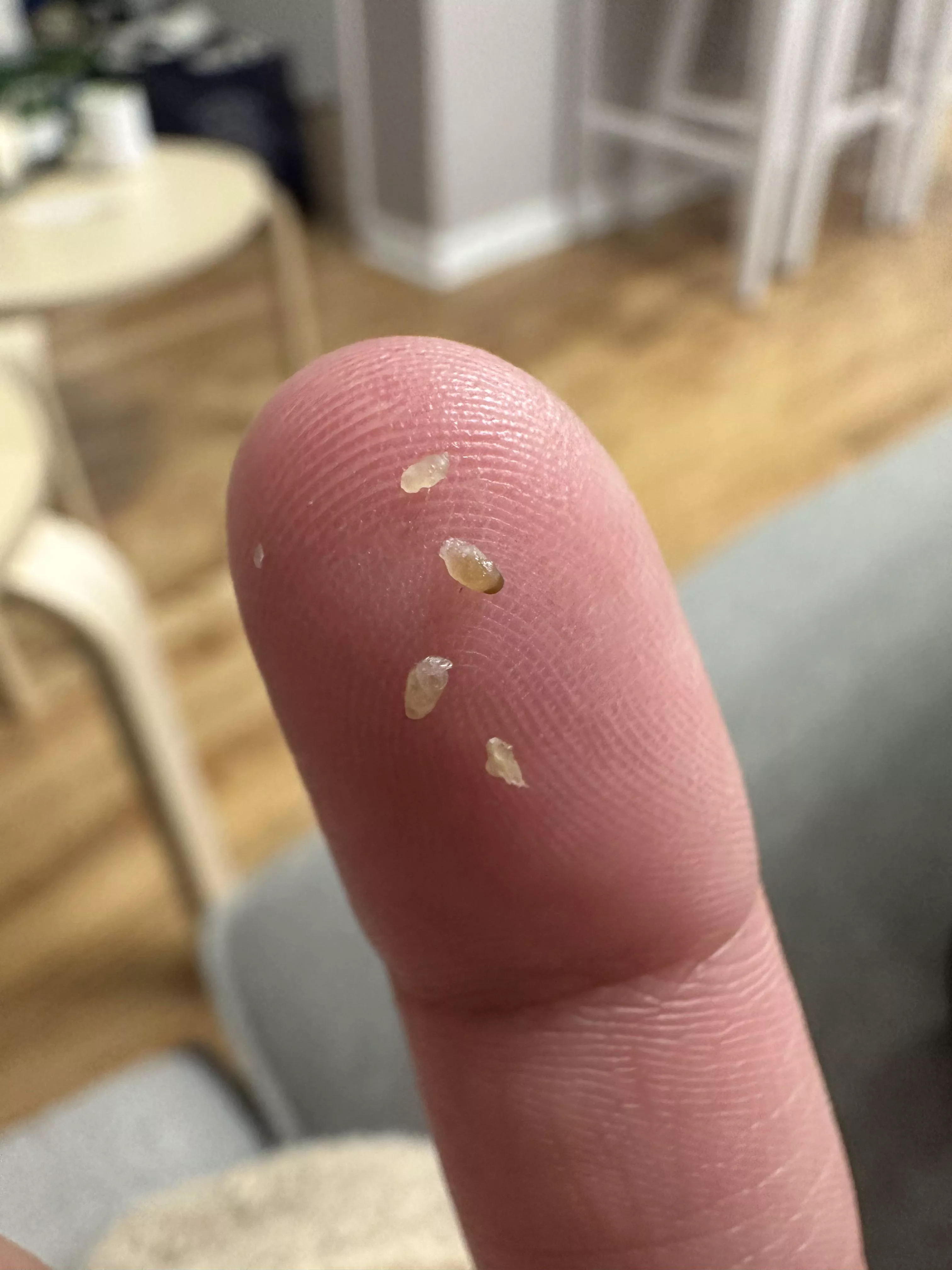 chest blackheads…. iphone 14 zoom goes crazy